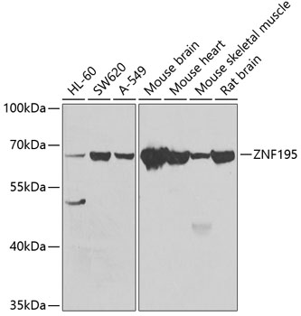 ZNF195 Polyclonal Antibody (E-AB-61661)