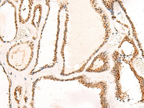 DCAF10 Polyclonal Antibody (E-AB-18947)