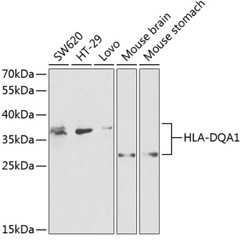 HLA-DQA1 Polyclonal Antibody (E-AB-60655)