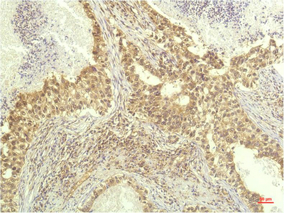 p70 S6 kinase alpha Monoclonal Antibody (E-AB-22198)