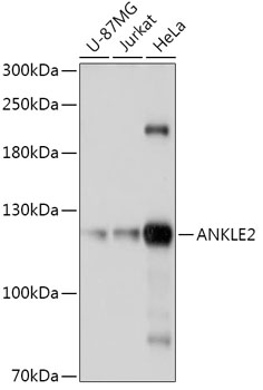 ANKLE2 Polyclonal Antibody (E-AB-91854)