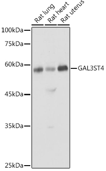 GAL3ST4 Polyclonal Antibody (E-AB-92625)