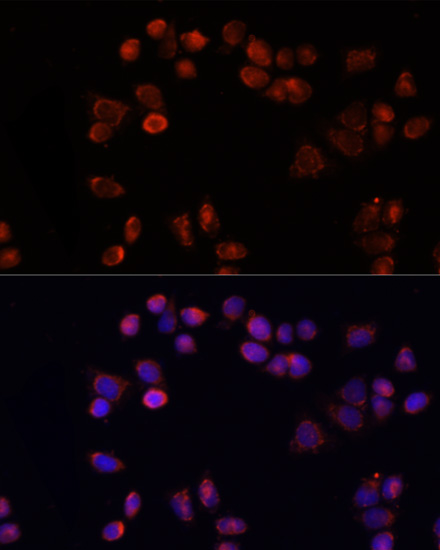 SLC25A4 Polyclonal Antibody (E-AB-66393)