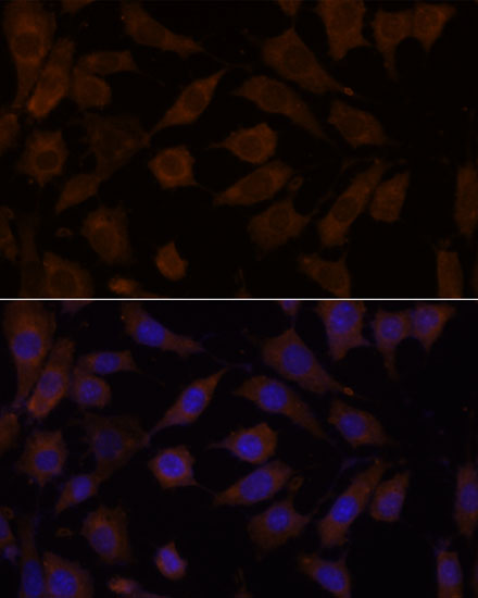 OXSR1 Polyclonal Antibody (E-AB-65208)