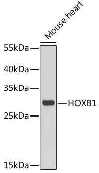 HOXB1 Polyclonal Antibody (E-AB-61253)