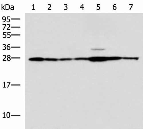 RPL10A Polyclonal Antibody (E-AB-19177)