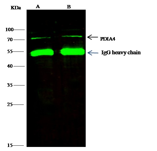 Recombinant ERP72/PDIA4 Monoclonal Antibody (AN300439P)