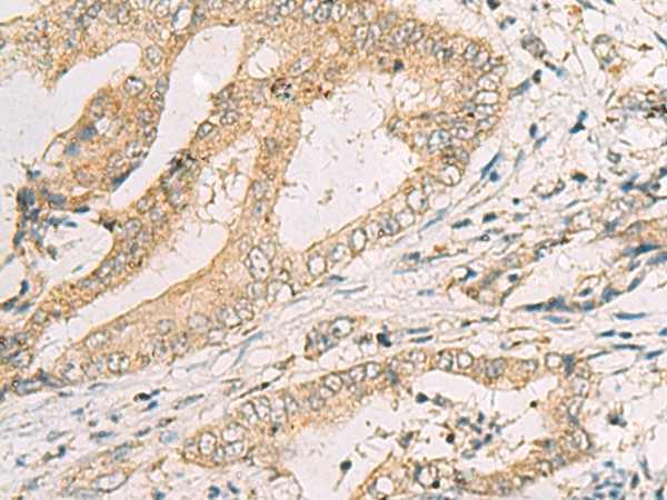 SPACA1 Polyclonal Antibody (E-AB-19214)