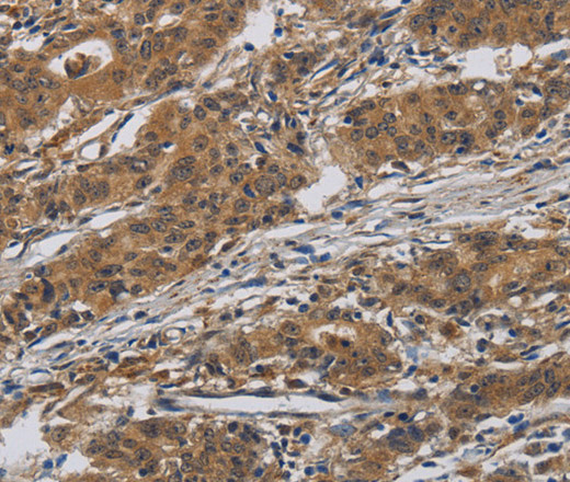 INPPL1 Polyclonal Antibody (E-AB-13338)