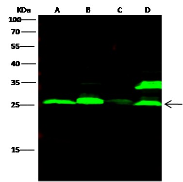 Recombinant Cathepsin L1/CTSL1 Monoclonal Antibody (AN300341P)