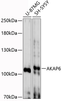 AKAP6 Polyclonal Antibody (E-AB-90484)