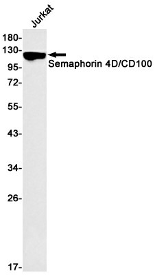 Recombinant Semaphorin 4D Monoclonal Antibody (E-AB-81485)