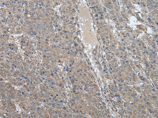 USP32 Polyclonal Antibody (E-AB-18516)