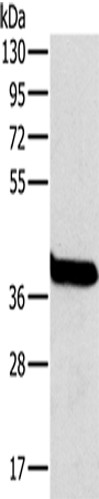 OTC Polyclonal Antibody (E-AB-11461)