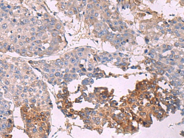 NIPSNAP1 Polyclonal Antibody (E-AB-52088)