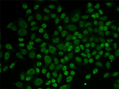RAD54L2 Polyclonal Antibody (E-AB-64733)
