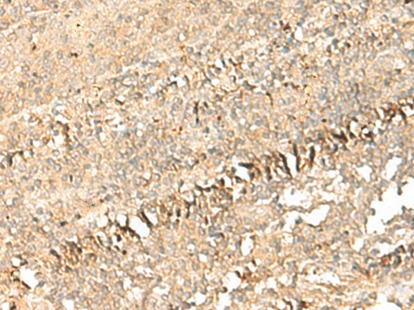PSD4 Polyclonal Antibody (E-AB-18879)
