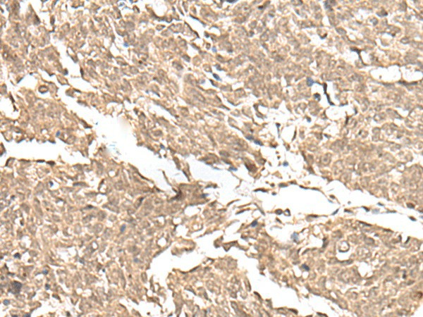 KDM2A Polyclonal Antibody (E-AB-17949)
