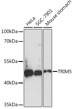 TRIM5 Polyclonal Antibody (E-AB-91740)