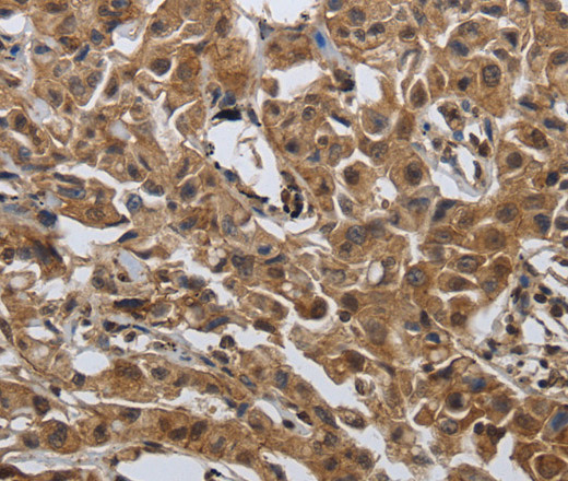 PDCD7 Polyclonal Antibody (E-AB-16027)