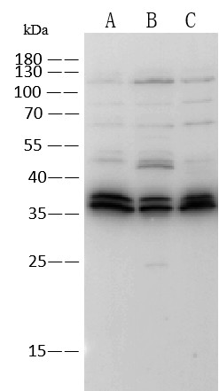Recombinant TROP-2/TACSTD2 Monoclonal Antibody (AN300566P)