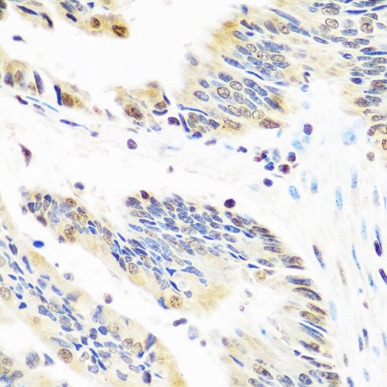 Snail Polyclonal Antibody (E-AB-61002)