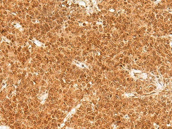 TOR1A Polyclonal Antibody (E-AB-52709)