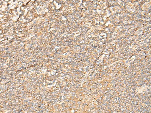 EIF3C Polyclonal Antibody (E-AB-52777)