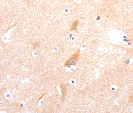 CELSR2 Polyclonal Antibody (E-AB-16124)