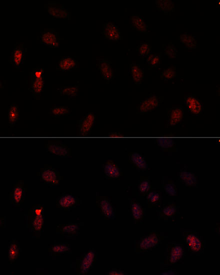 PAX6 Polyclonal Antibody (E-AB-61653)