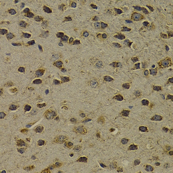 OGG1 Polyclonal Antibody (E-AB-60300)