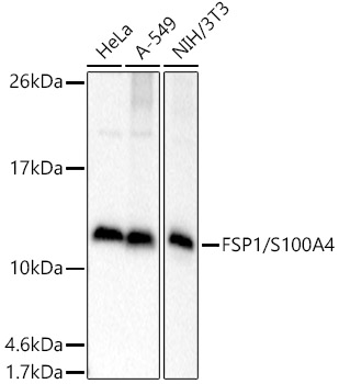 FSP1/S100A4 Polyclonal Antibody (E-AB-93346)