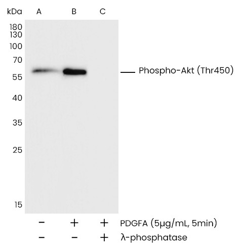 Recombinant Phospho-AKT1 (Thr450) Monoclonal Antibody (AN300087L)