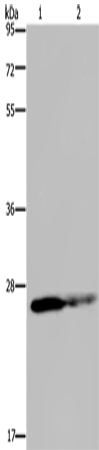 GSTP1 Polyclonal Antibody (E-AB-11287)