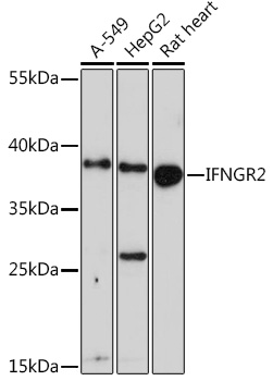 IFNGR2 Polyclonal Antibody (E-AB-90758)