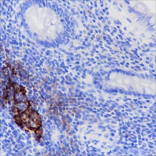 Recombinant CD35 Monoclonal Antibody (AN301476L)