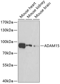 ADAM15 Polyclonal Antibody (E-AB-67909)