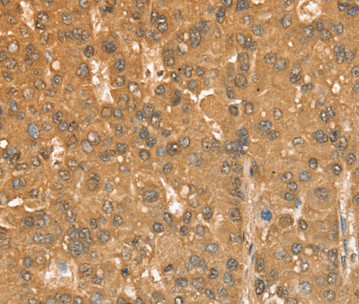 CXCR4 Polyclonal Antibody (E-AB-11047)