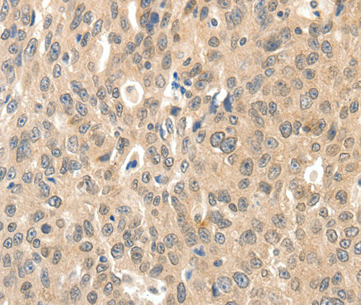 ROS1 Polyclonal Antibody (E-AB-12856)