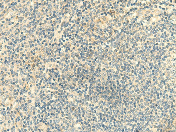 CLEC10A Polyclonal Antibody (E-AB-18221)