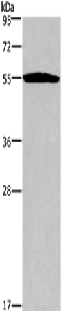 SERPINA1 Polyclonal Antibody (E-AB-15449)