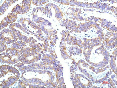 STAT1 Monoclonal Antibody (E-AB-22203)
