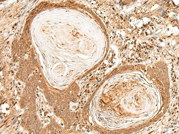 FIZ1 Polyclonal Antibody (E-AB-17965)