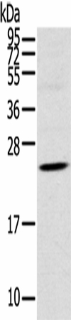 TSPAN13 Polyclonal Antibody (E-AB-16923)