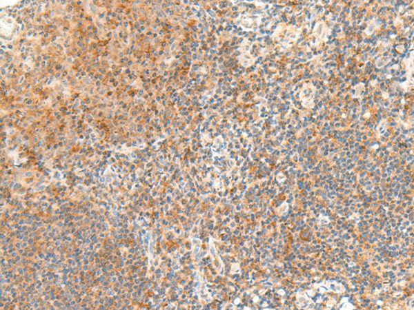 RAPGEF1 Polyclonal Antibody (E-AB-19964)