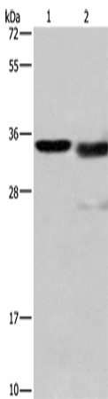 Cathepsin L Polyclonal Antibody (E-AB-13976)