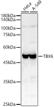 TBX6 Polyclonal Antibody (E-AB-91673)