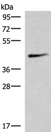 SMPD2 Polyclonal Antibody (E-AB-19030)