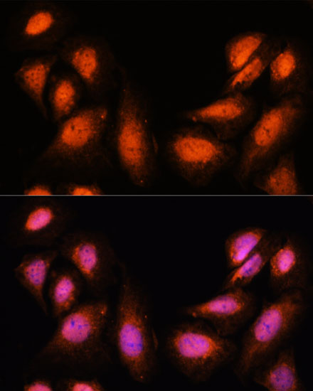 SUPT6H Polyclonal Antibody (E-AB-66819)