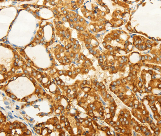FZD6 Polyclonal Antibody (E-AB-12926)